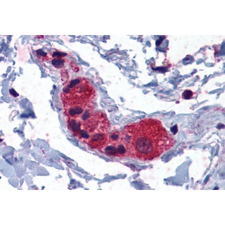 Immunohistochemistry - Anti-MYRIP Antibody (A83946) - Antibodies.com