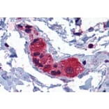 Immunohistochemistry - Anti-MYRIP Antibody (A83946) - Antibodies.com