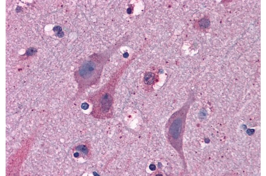 Immunohistochemistry - Anti-MYRIP Antibody (A83946) - Antibodies.com