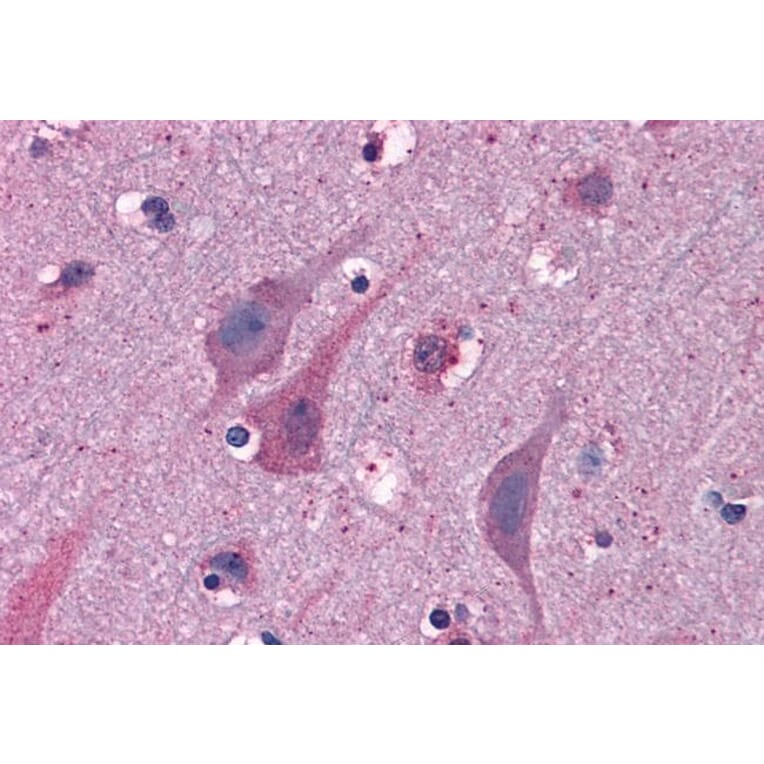 Immunohistochemistry - Anti-MYRIP Antibody (A83946) - Antibodies.com