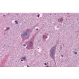 Immunohistochemistry - Anti-MYRIP Antibody (A83946) - Antibodies.com
