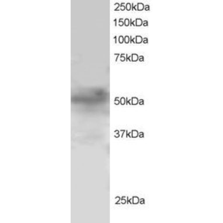 Western Blot - Anti-FOXQ1 Antibody (A83947) - Antibodies.com