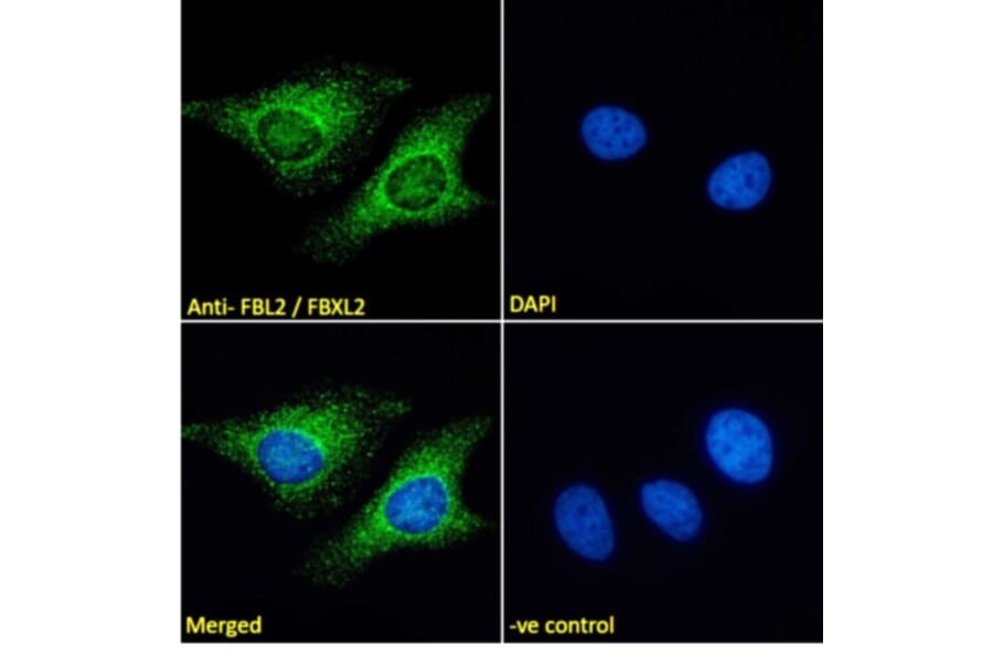 Immunofluorescence - Anti-FBXL2 Antibody (A83949) - Antibodies.com