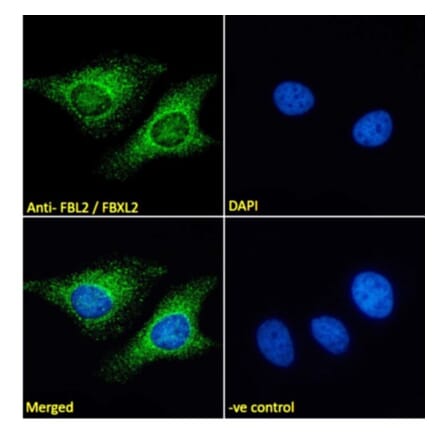 Immunofluorescence - Anti-FBXL2 Antibody (A83949) - Antibodies.com