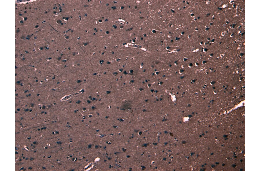 Immunohistochemistry - Anti-FBXL2 Antibody (A83949) - Antibodies.com