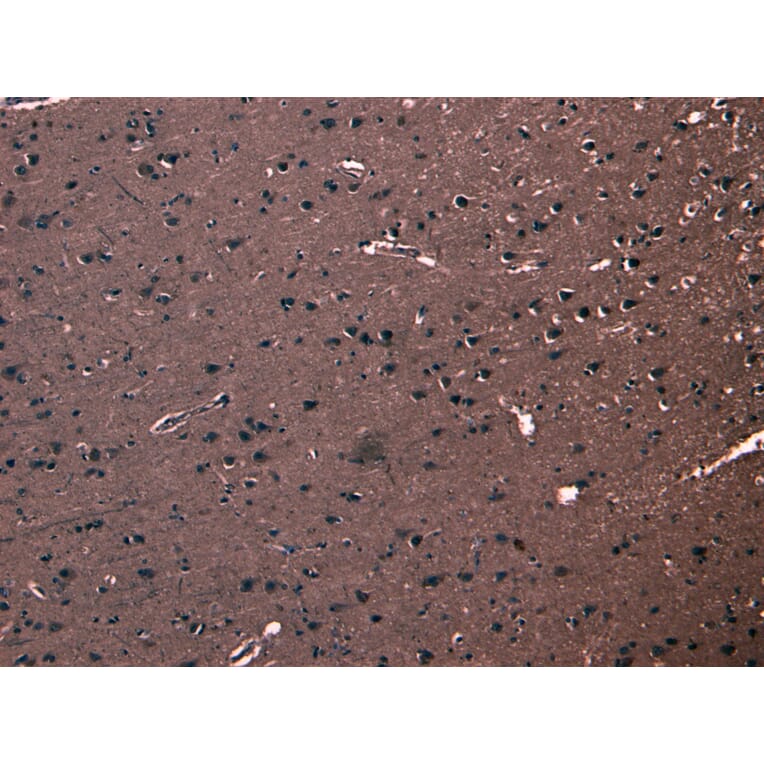 Immunohistochemistry - Anti-FBXL2 Antibody (A83949) - Antibodies.com