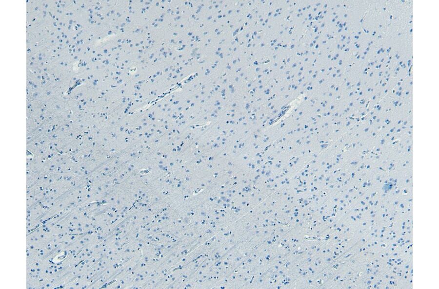 Immunohistochemistry - Anti-FBXL2 Antibody (A83949) - Antibodies.com