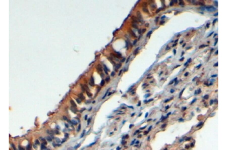 Immunohistochemistry - Anti-FbxL12 Antibody (A83950) - Antibodies.com