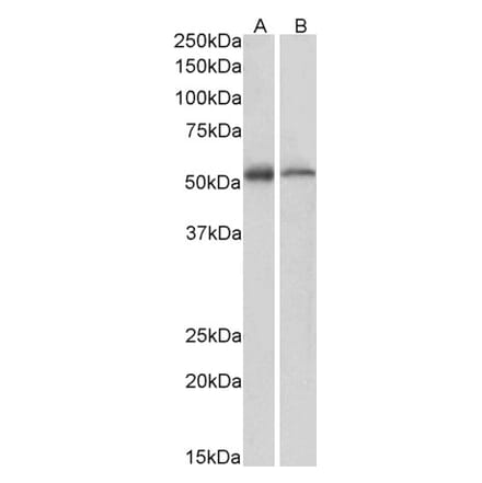 Western Blot - Anti-UBXD8 Antibody (A83951) - Antibodies.com