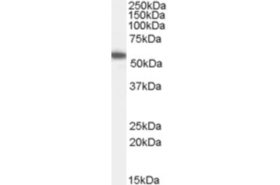 Western Blot - Anti-UBXD8 Antibody (A83951) - Antibodies.com