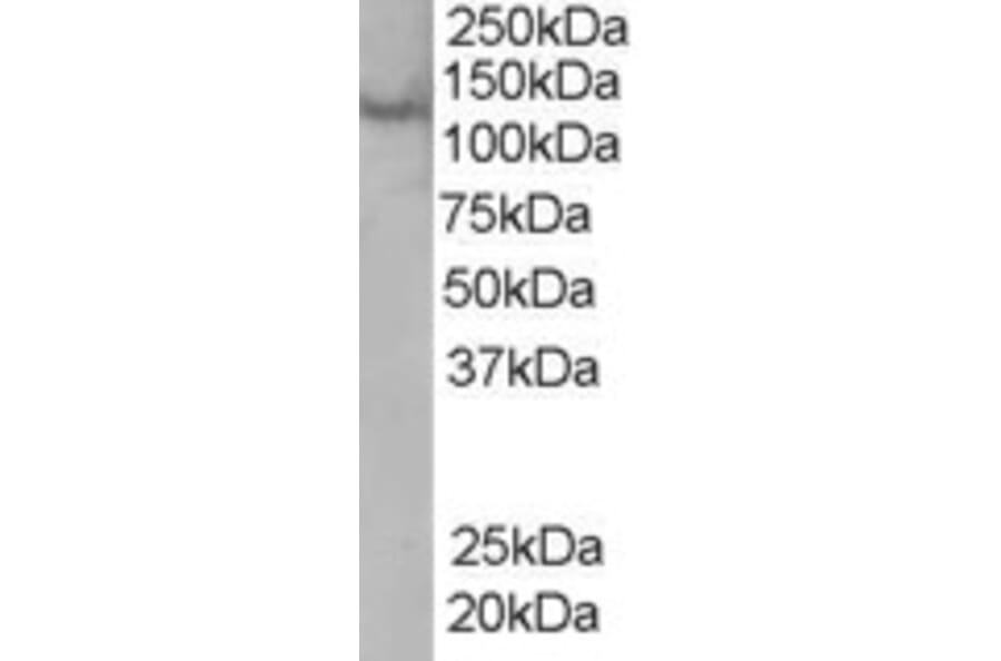 Western Blot - Anti-Rabenosyn 5 Antibody (A83952) - Antibodies.com