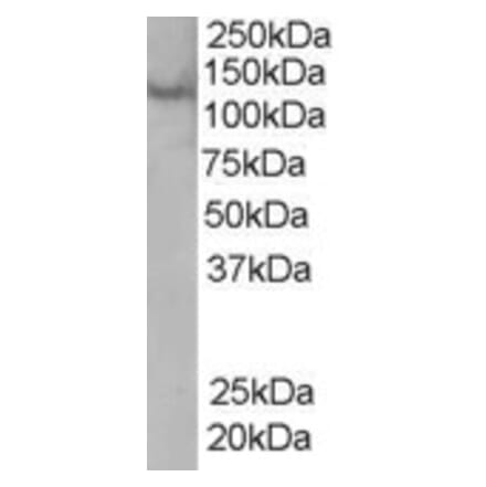 Western Blot - Anti-Rabenosyn 5 Antibody (A83952) - Antibodies.com