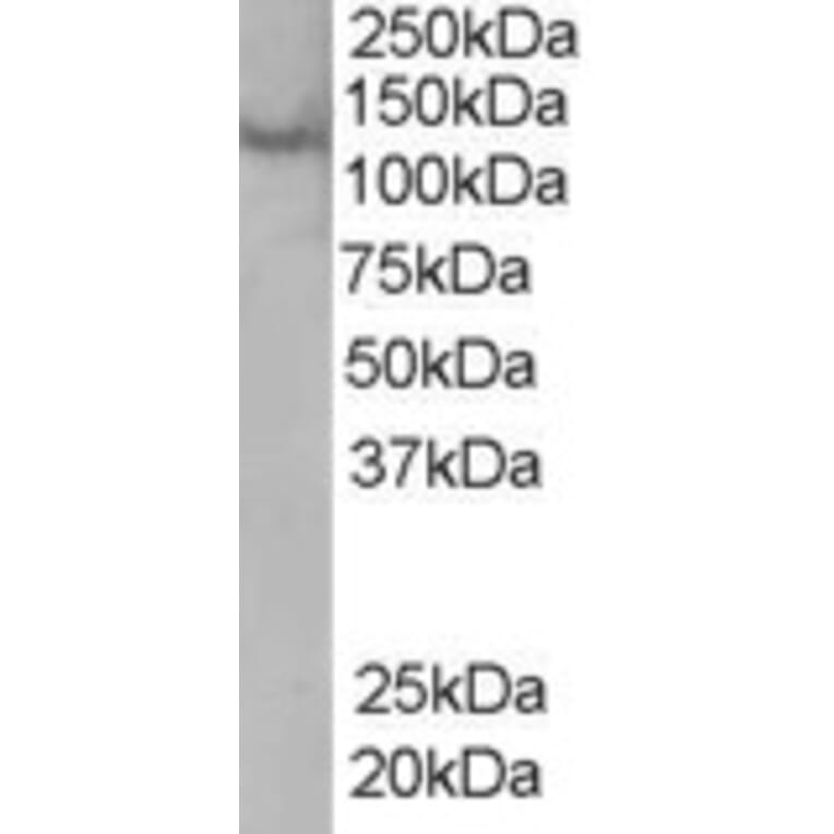 Western Blot - Anti-Rabenosyn 5 Antibody (A83952) - Antibodies.com