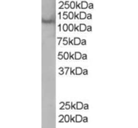 Western Blot - Anti-ZFYVE20 Antibody (A83952) - Antibodies.com