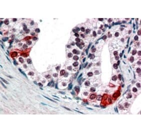Immunohistochemistry - Anti-BAF57/SMARCE1 Antibody (A83953) - Antibodies.com