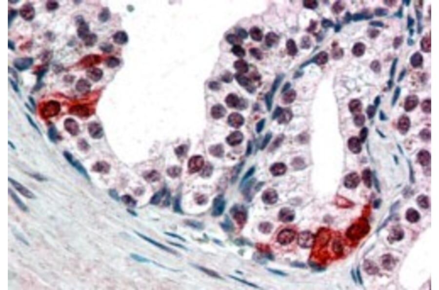 Immunohistochemistry - Anti-BAF57/SMARCE1 Antibody (A83953) - Antibodies.com