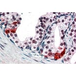 Immunohistochemistry - Anti-BAF57/SMARCE1 Antibody (A83953) - Antibodies.com