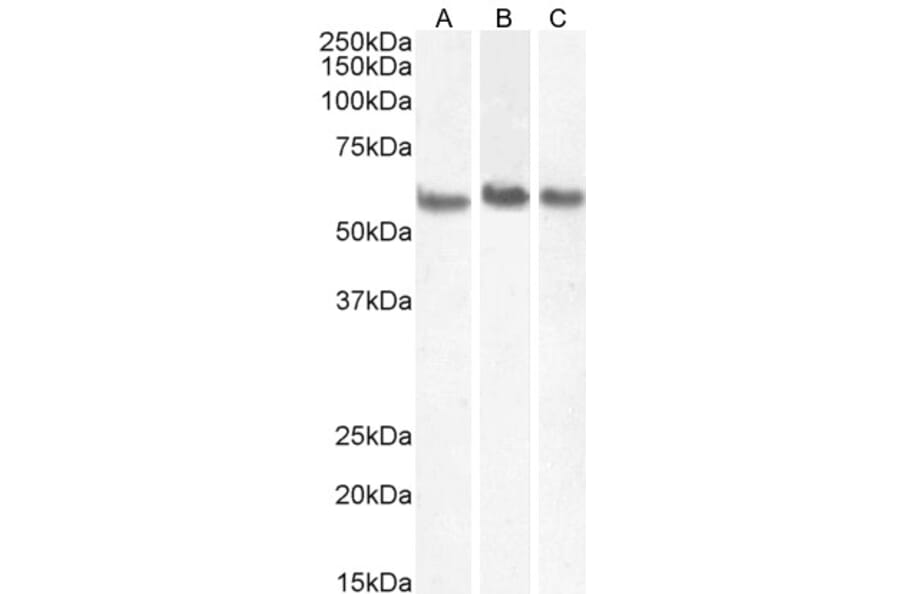 Western Blot - Anti-Coronin 1a/TACO Antibody (A83954) - Antibodies.com