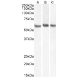 Western Blot - Anti-Coronin 1a/TACO Antibody (A83954) - Antibodies.com