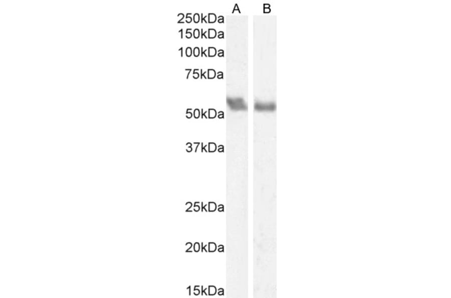 Western Blot - Anti-Coronin 1a/TACO Antibody (A83954) - Antibodies.com