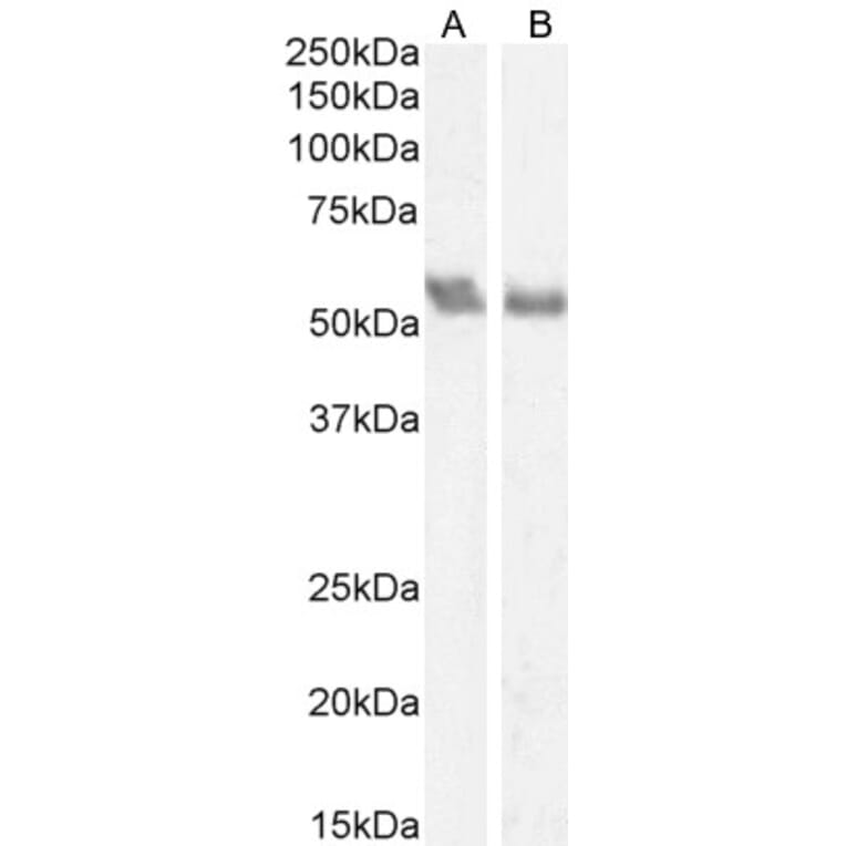 Western Blot - Anti-Coronin 1a/TACO Antibody (A83954) - Antibodies.com