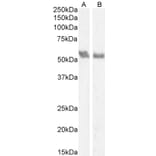 Western Blot - Anti-Coronin 1a/TACO Antibody (A83954) - Antibodies.com