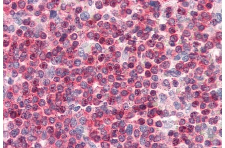 Immunohistochemistry - Anti-Coronin 1a/TACO Antibody (A83954) - Antibodies.com
