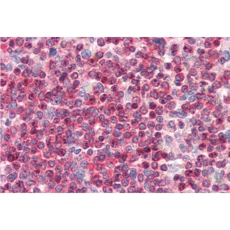 Immunohistochemistry - Anti-Coronin 1a/TACO Antibody (A83954) - Antibodies.com