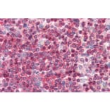 Immunohistochemistry - Anti-Coronin 1a/TACO Antibody (A83954) - Antibodies.com