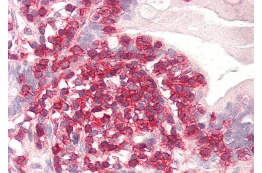 Immunohistochemistry - Anti-Coronin 1a/TACO Antibody (A83954) - Antibodies.com