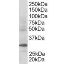 Western Blot - Anti-FBW2 Antibody (A83956) - Antibodies.com