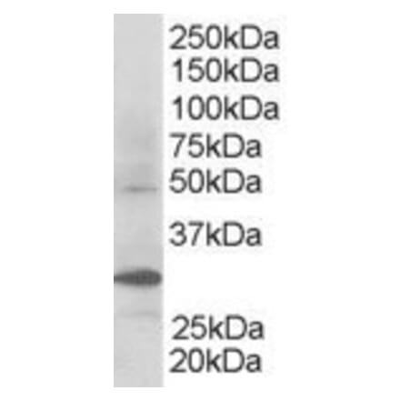 Western Blot - Anti-FBW2 Antibody (A83956) - Antibodies.com