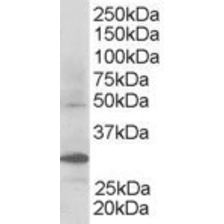 Western Blot - Anti-FBW2 Antibody (A83956) - Antibodies.com