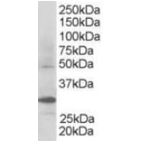 Western Blot - Anti-FBW2 Antibody (A83956) - Antibodies.com