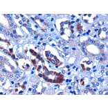 Immunohistochemistry - Anti-FBW2 Antibody (A83956) - Antibodies.com