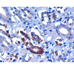 Immunohistochemistry - Anti-FBXW2 Antibody (A83956) - Antibodies.com