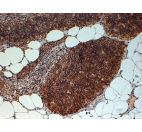 Immunohistochemistry - Anti-FOXN1 Antibody (A83957) - Antibodies.com