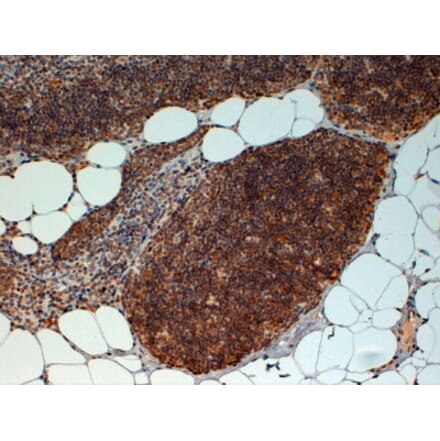 Immunohistochemistry - Anti-FOXN1 Antibody (A83957) - Antibodies.com