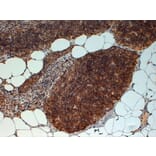 Immunohistochemistry - Anti-FOXN1 Antibody (A83957) - Antibodies.com