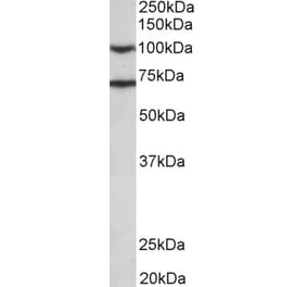 Western Blot - Anti-EPS8 Antibody (A83960) - Antibodies.com