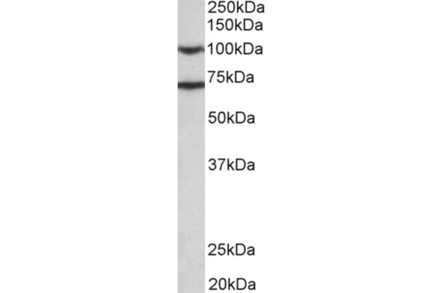 Western Blot - Anti-EPS8 Antibody (A83960) - Antibodies.com