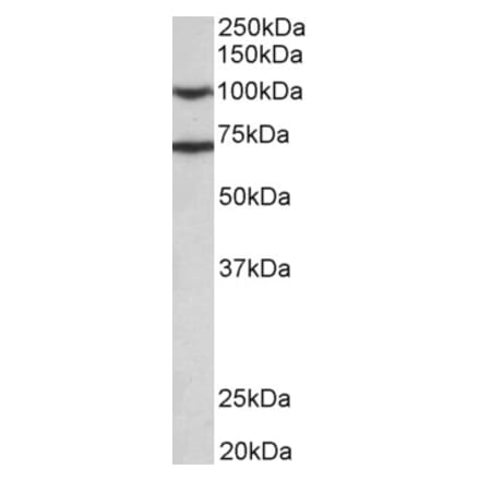 Western Blot - Anti-EPS8 Antibody (A83960) - Antibodies.com