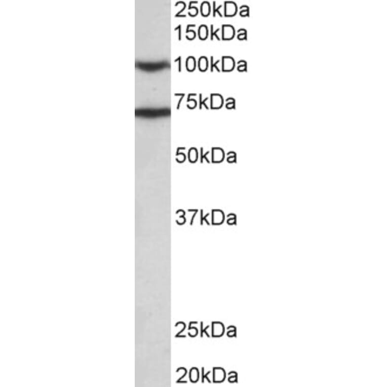 Western Blot - Anti-EPS8 Antibody (A83960) - Antibodies.com