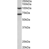 Western Blot - Anti-EPS8 Antibody (A83960) - Antibodies.com