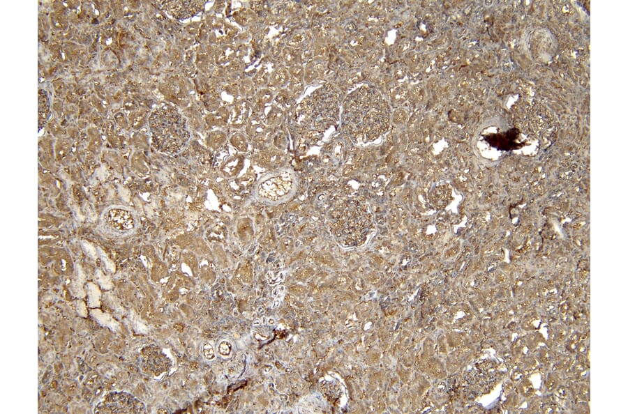 Immunohistochemistry - Anti-EPS8 Antibody (A83960) - Antibodies.com