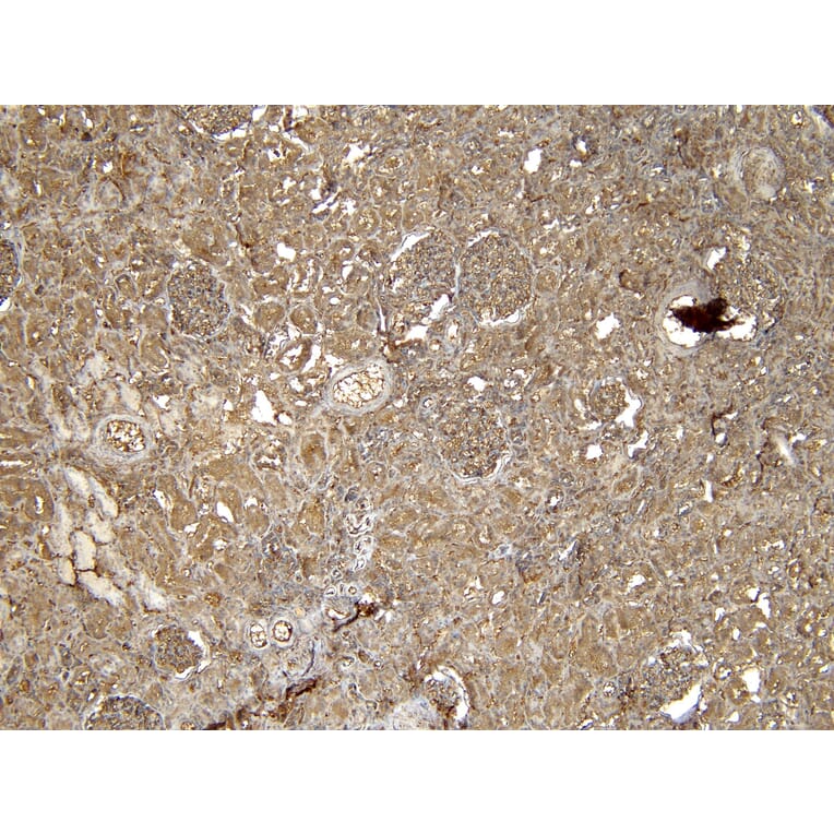 Immunohistochemistry - Anti-EPS8 Antibody (A83960) - Antibodies.com
