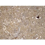 Immunohistochemistry - Anti-EPS8 Antibody (A83960) - Antibodies.com