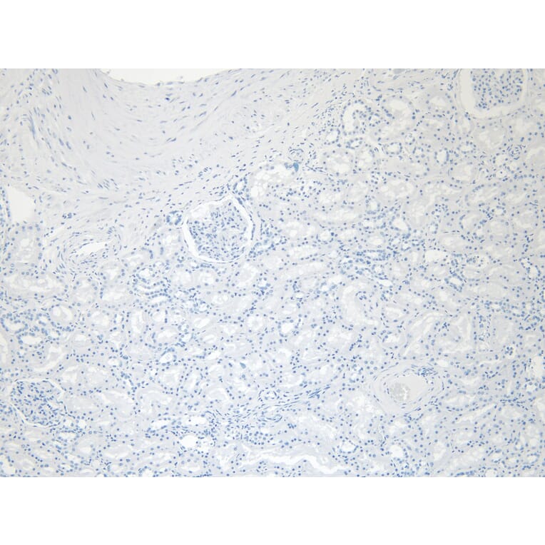 Immunohistochemistry - Anti-EPS8 Antibody (A83960) - Antibodies.com