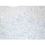 Immunohistochemistry - Anti-EPS8 Antibody (A83960) - Antibodies.com