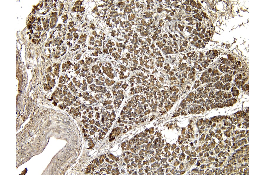 Immunohistochemistry - Anti-EPS8 Antibody (A83960) - Antibodies.com
